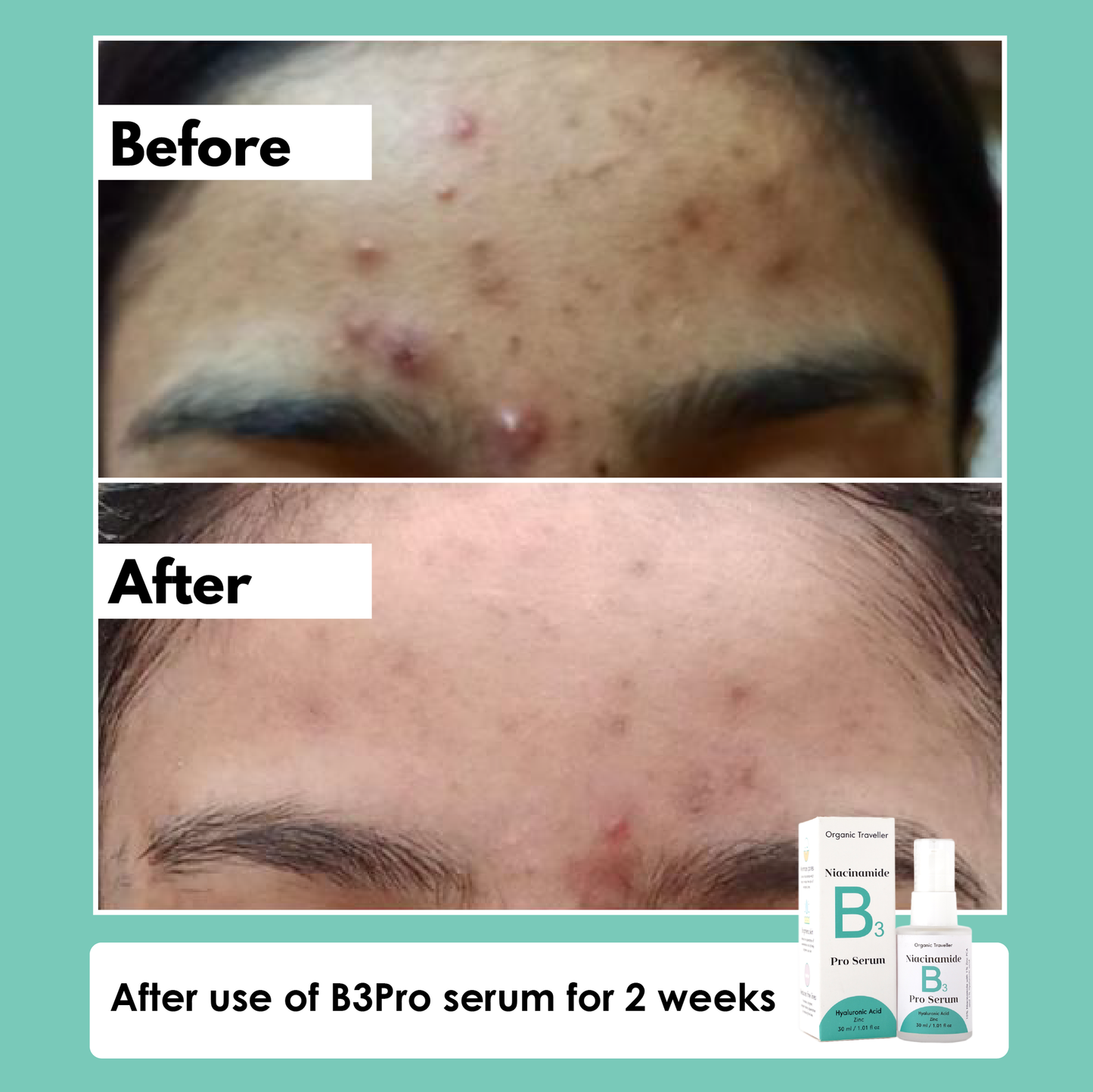 Organic Traveller Niacinamide B3 Pro Serum